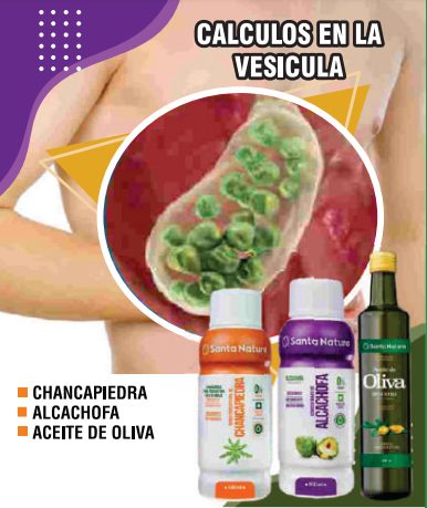 Calculos en la vesicula