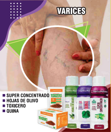 Varises